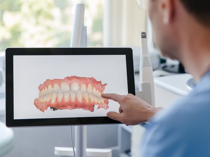 Scanare în scop protetic/diagnostic